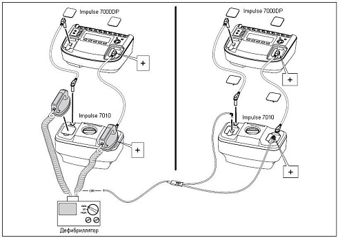 Анализатор дефибрилляторов и транскутанных кардиостимуляторов Impulse 7000DP/7010
